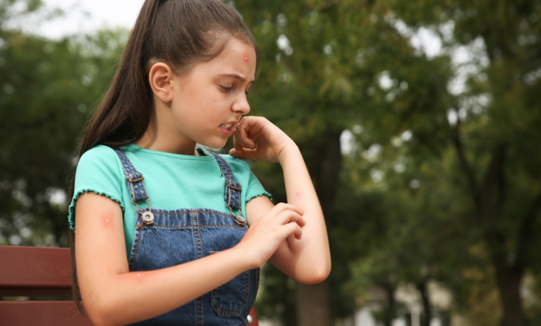 Punture di insetti nei bambini: prevenire e trattare