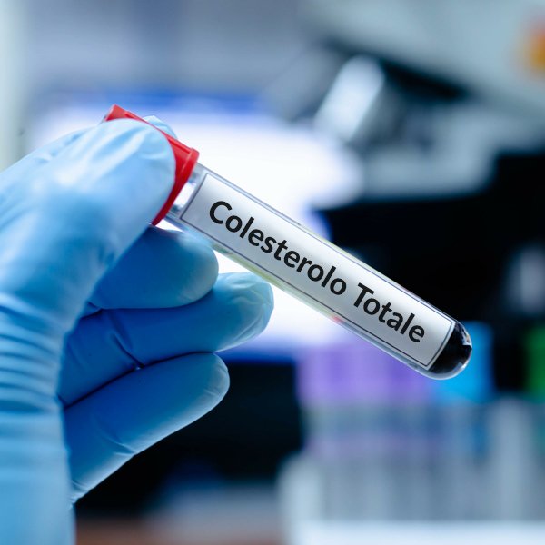 Misurazione colesterolo totale